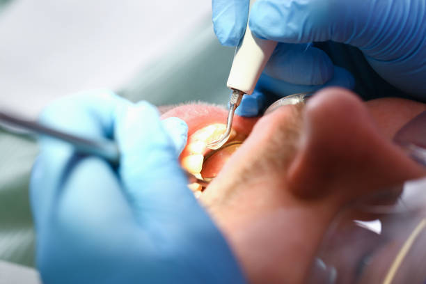 Best Emergency Denture Repair in Denver City, TX
