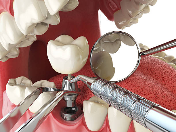 Best Emergency Dental Care for Broken or Chipped Teeth in Denver City, TX