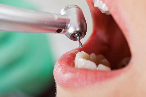 Best Pediatric Emergency Dentist in Denver City, TX